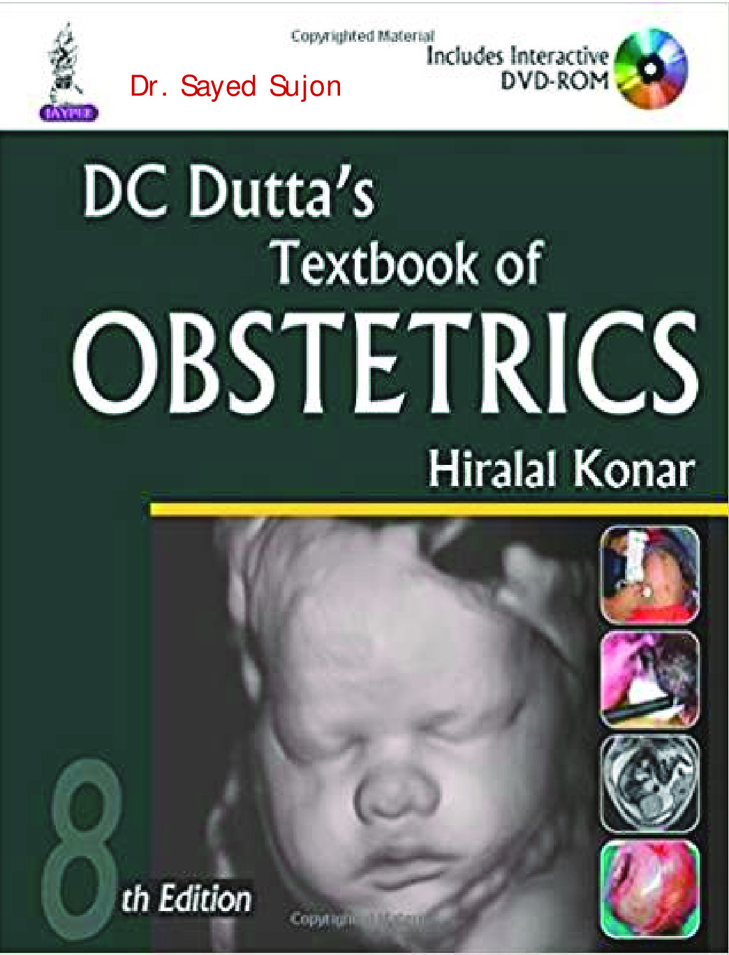 Textbook Of  Obstetrics